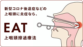 上咽頭擦過療法とは？